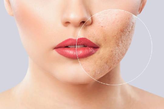 Derma Range